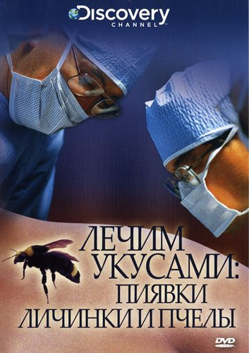 Discovery Лечим укусами Пиявки личинки и пчелы на DVD